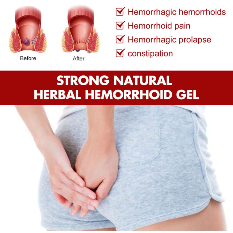 Gentle Herbal Hemorrhoid Gel - Natural Daily Soothing Care - Image 3