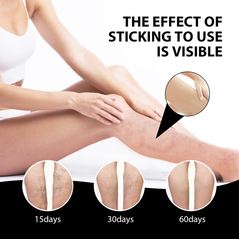 Natural Ice Silk Foot Pads with Wormwood for Daily Comfort - Image 3