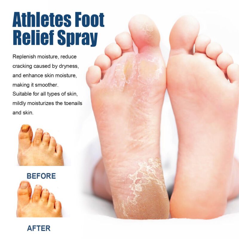 Foot Care Spray: Natural Daily Moisturizer for Soothing Fresh Smooth Feet - Image 3