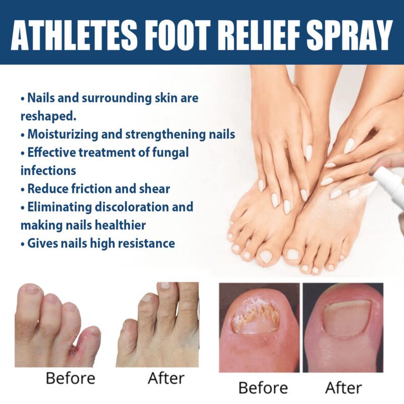 Foot Care Spray: Natural Daily Moisturizer for Soothing Fresh Smooth Feet - Image 4