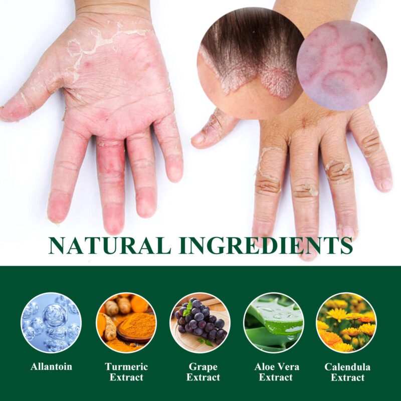 South Moon Calendula Cream - Gentle Daily Moisturizer for Soothed Skin - Image 5