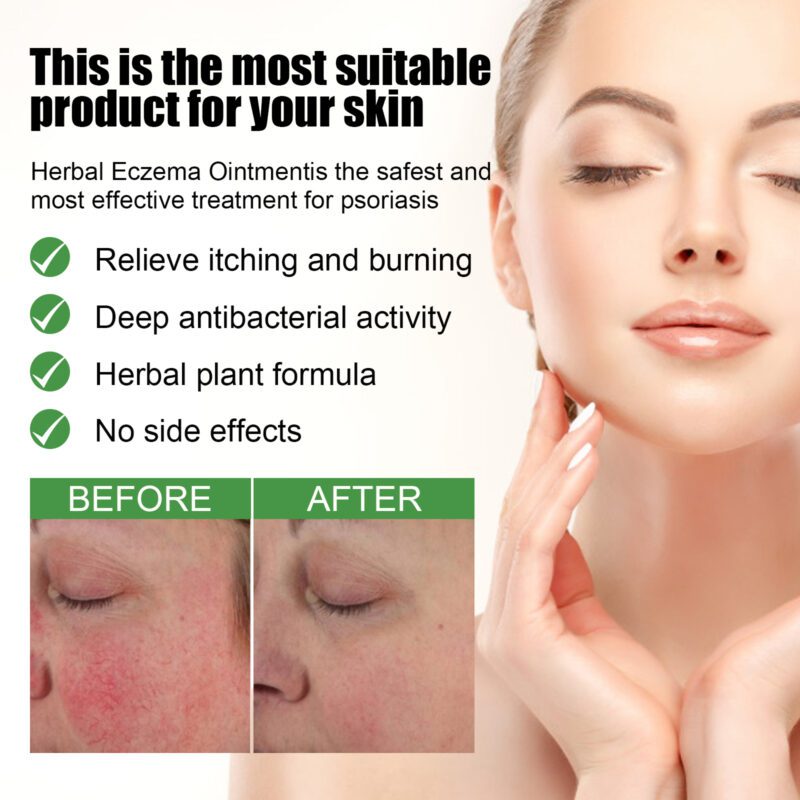 Gentle Herbal Ointment for Hands and Feet, Natural Daily Skin Care - Image 3
