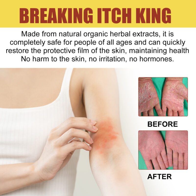 Soothing Skin Cream with Natural Lavender & Comfrey for Daily Itchy Skin Relief - Image 3
