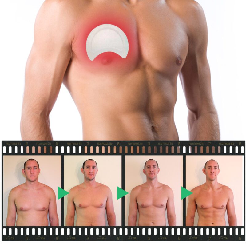 Men's Chest Care Patch with Natural Extracts for Daily Nourishment - Image 3