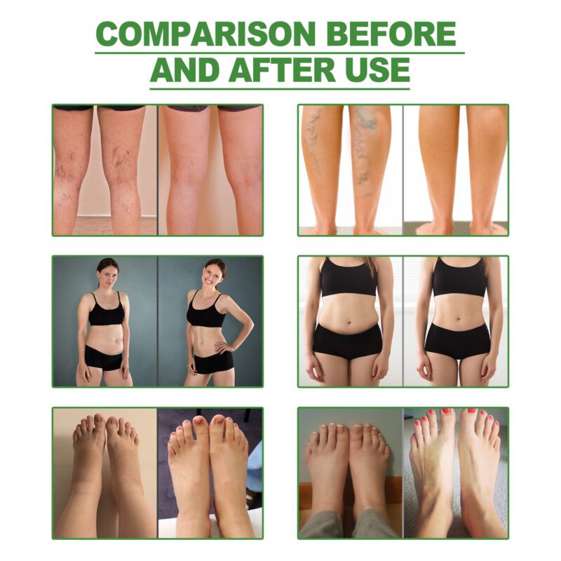 Soothing Foot Patches (10pcs) - Natural Daily Foot Care - Image 3