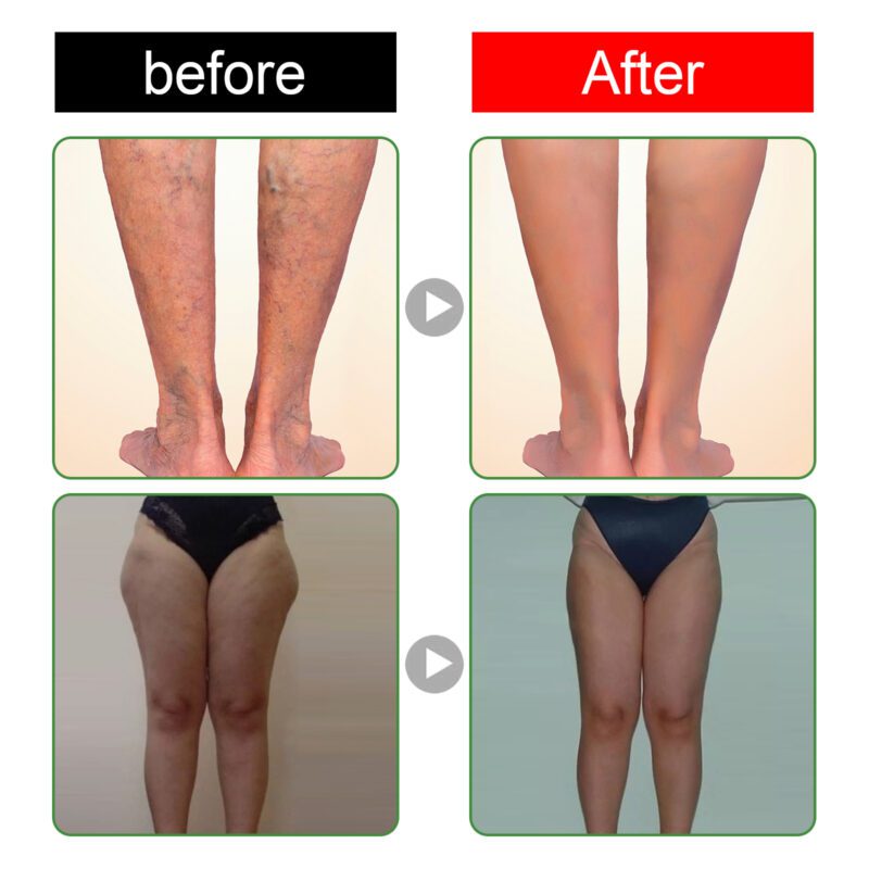Soothing Foot Patches (10pcs) - Natural Daily Foot Care - Image 4