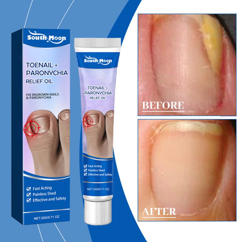 Natural Nail Ointment Gentle Daily Care with Aloe and Phellodendron for Soft Healthy Nails - Image 2