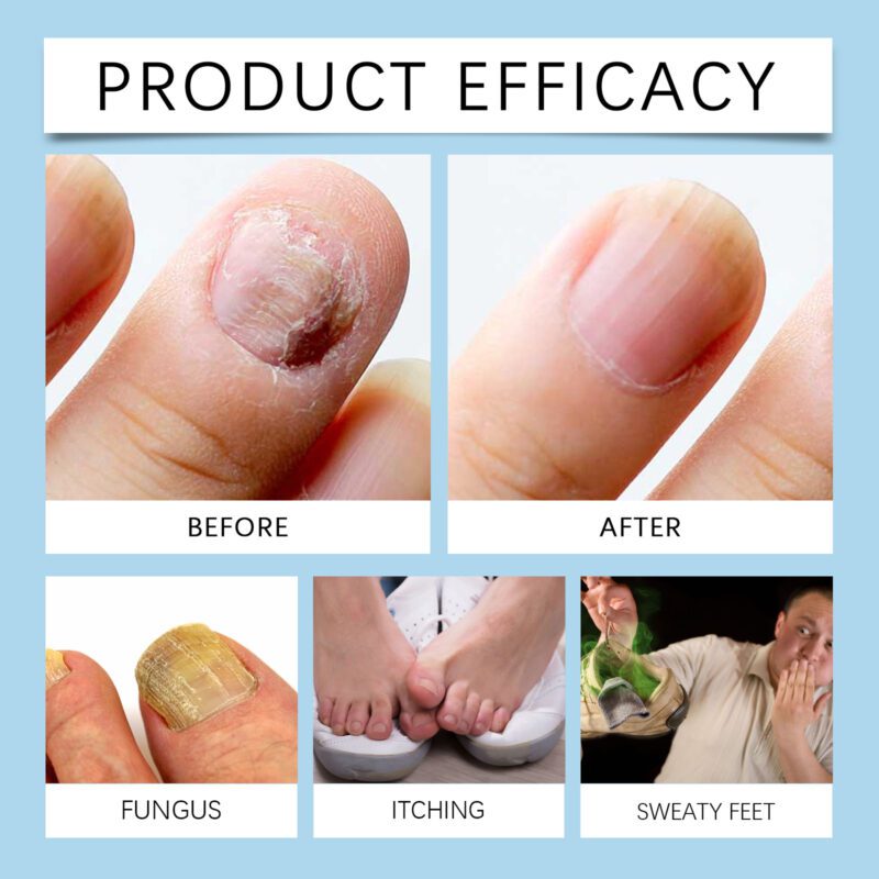 Natural Nail Care - Daily Cuticle Care with Soothing Glycerin - Image 6