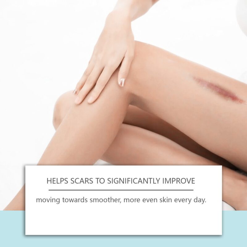 Daily Skincare Spray - Gentle Soothing Natural Moisturizer for Soft Skin - Image 3