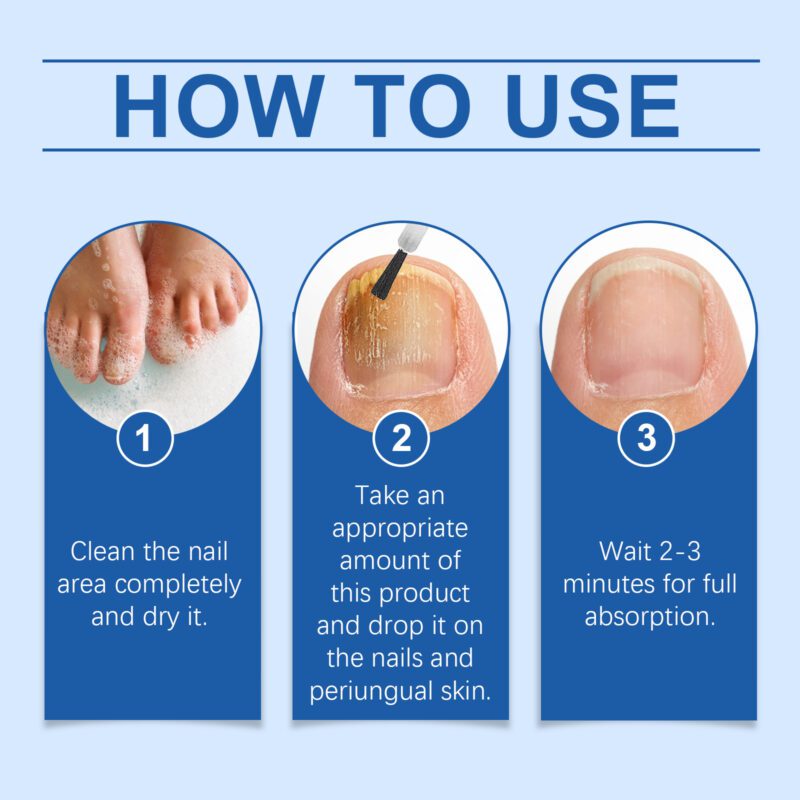 Natural Nail Care Essence with Aloe Vera & Phellodendron for Healthy Nails - Image 6