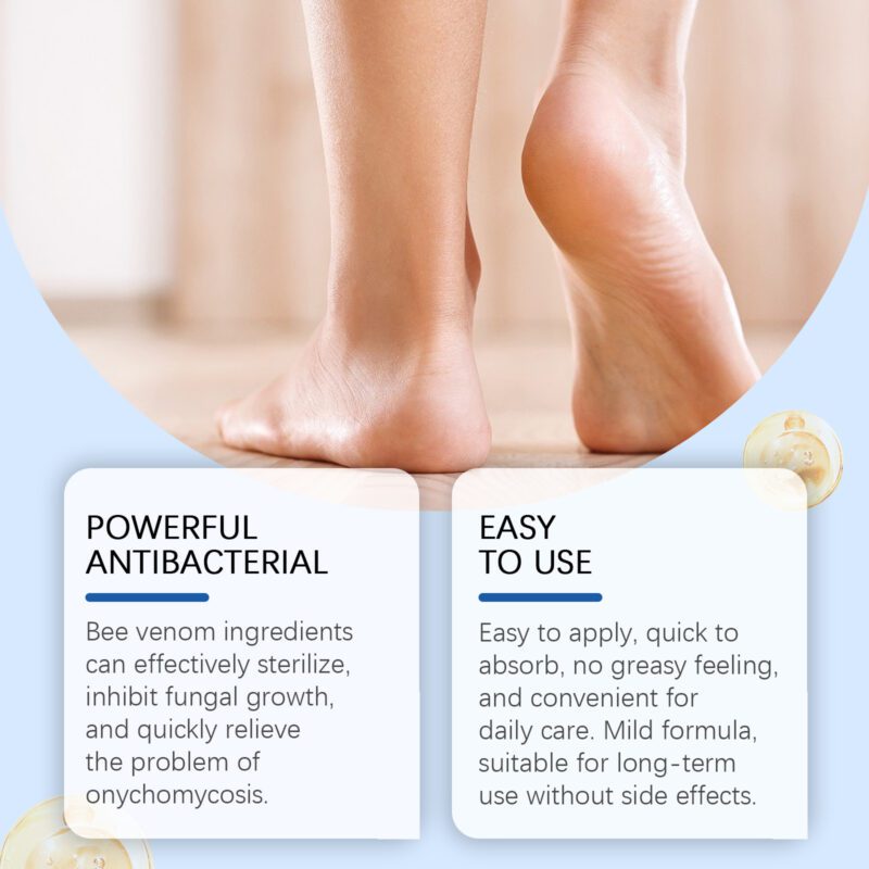 Natural Nail Care Essence with Aloe Vera & Phellodendron for Healthy Nails - Image 3