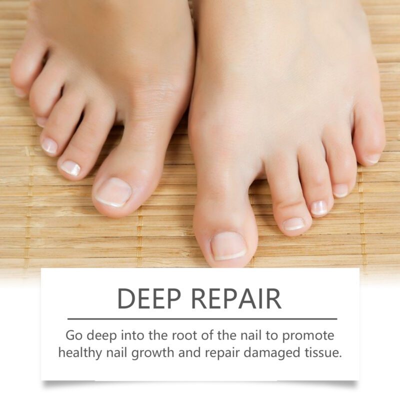 Natural Nail Care Essence with Aloe Vera & Phellodendron for Healthy Nails - Image 4